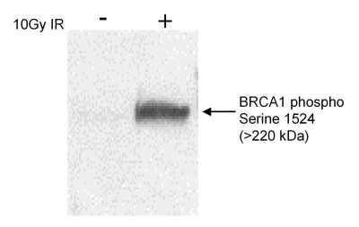 Western Blot: BRCA1 [p Ser1524] Antibody [NB100-200]